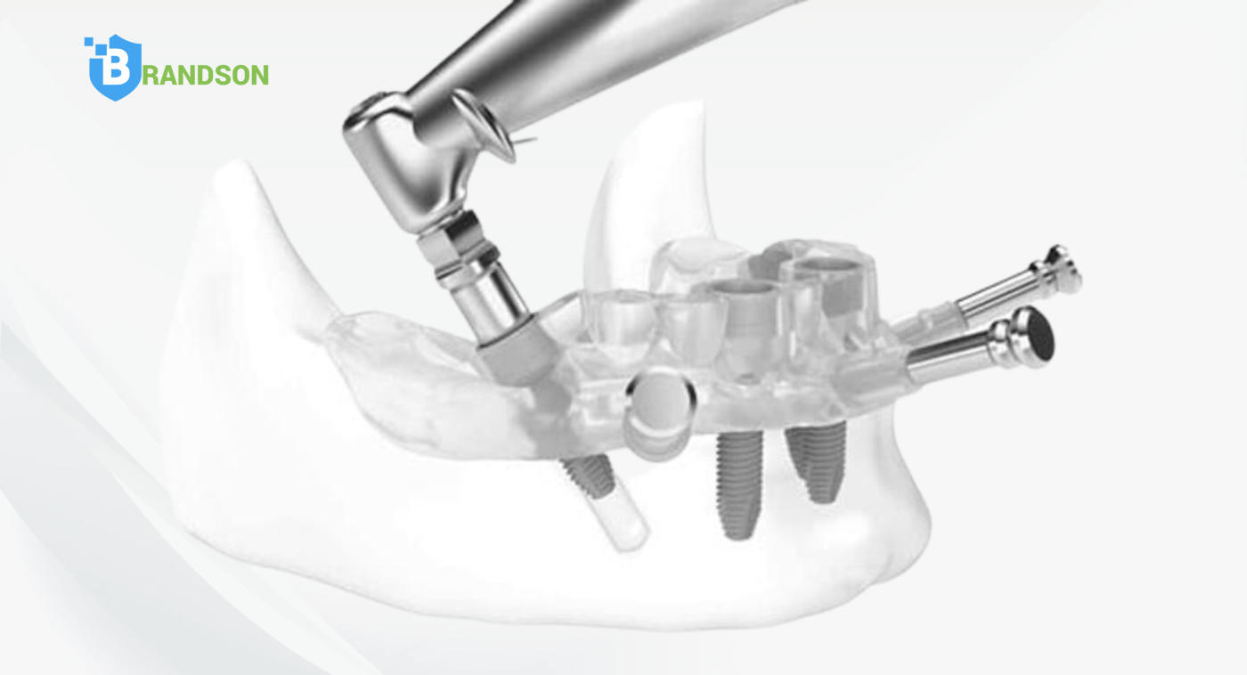 Kỹ Thuật Trong Điều Trị Cấy Ghép Implant (3D Guided Implant Surgery)