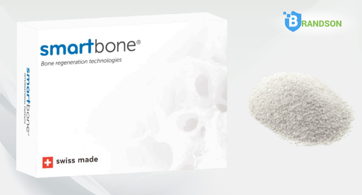 Xương Smart Bone Thuỵ Sĩ