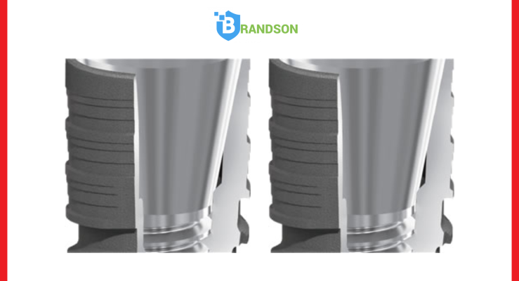 Thiết kế cổ nha chu giảm nguy cơ viêm nhiễm, tăng độ bền