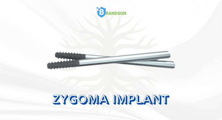 Zygoma Implant