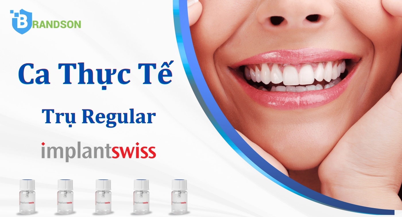 Ca thực tế regular ImplantSwiss hàm dưới