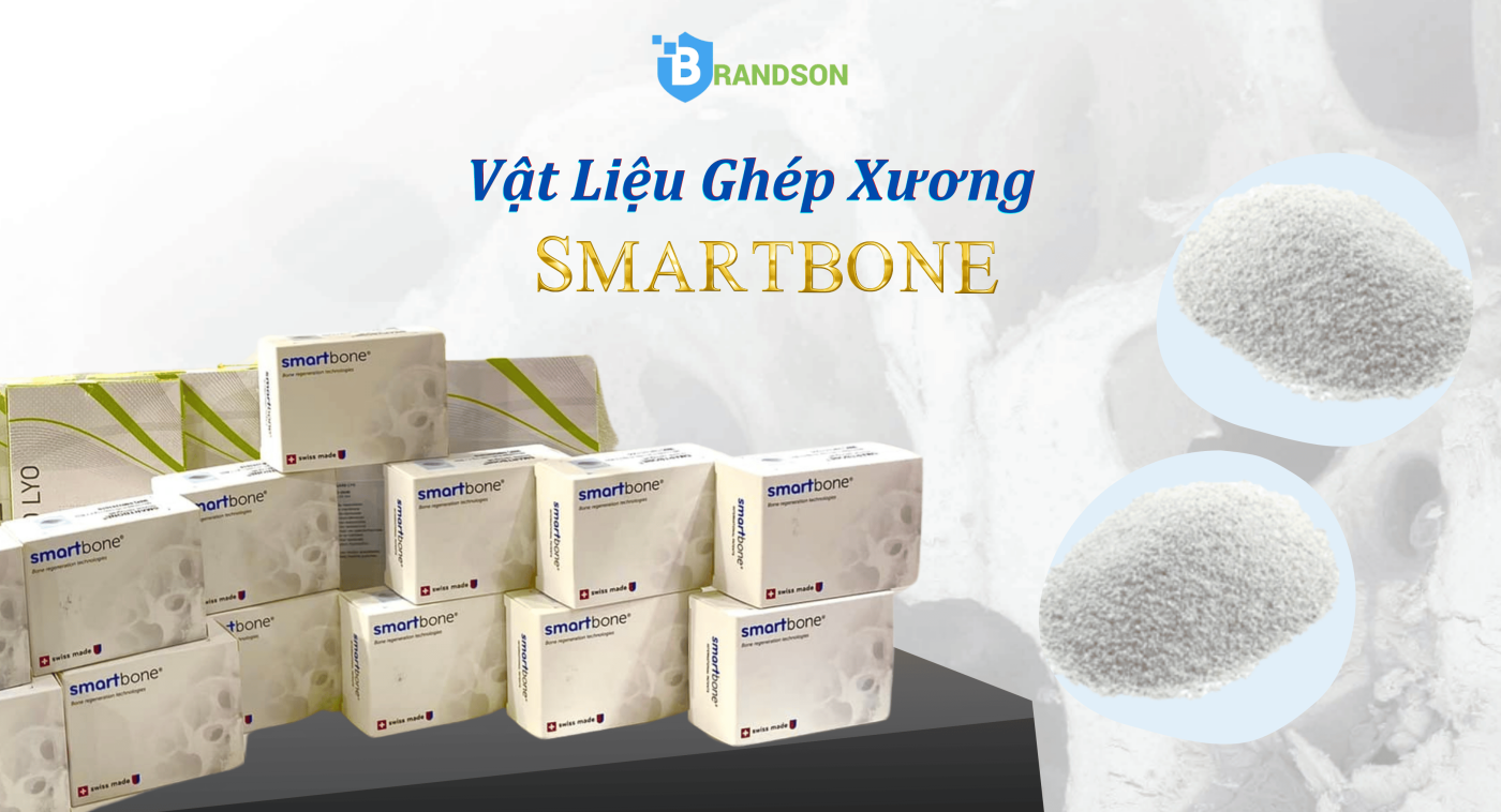 vật liệu ghép xương Smartbone